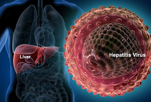 Correlation of serum alpha-fetoprotein (AFP) level with liver function parameters in hepatitis B virus (HBV) infected patients in Bangladeshi population